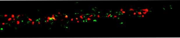 Neutrophils-Macs